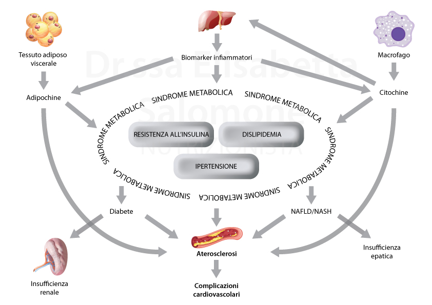 sindrome metabolica, cause, sintomi, rimedi, alimentazione, dieta, obesità, nutrizionista, napoli, nutrizionista napoli, soccavo, vomero, nutrizionista vomero, nutrizionista policlinico